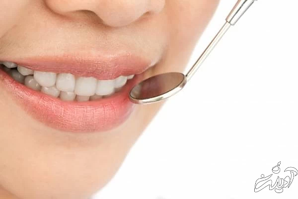 انواع لمینت